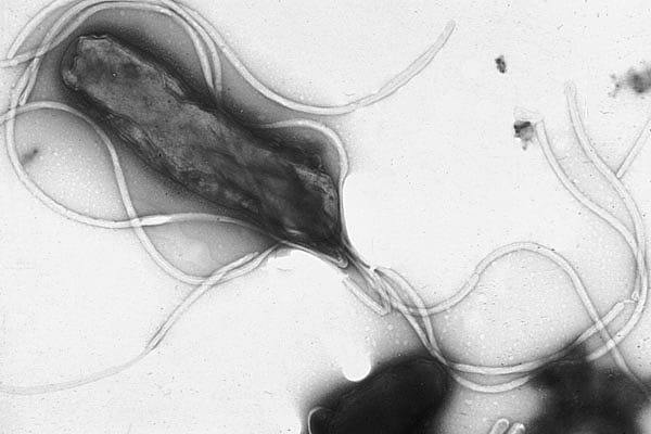 La Helicobacter pylori es una vacteria que afecta el estomago