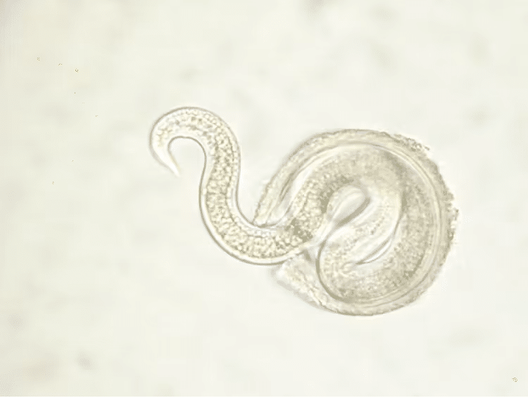 Larva de Toxocara. SuSanA Secretariat/Flickr, CC BY-NC